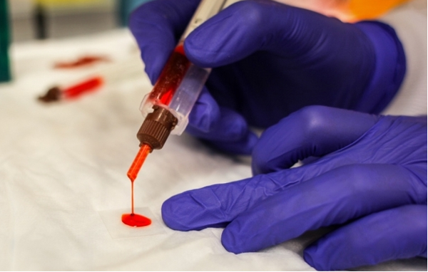 Bioadhesive and tissue interactions